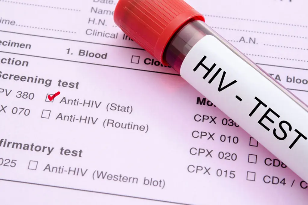 HIV Test at Home Dubai