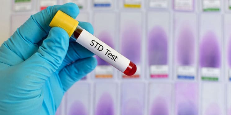 std-testing